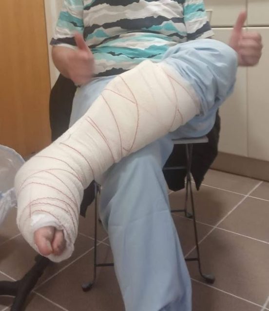 Un hombre sentado con la pierna vendada hasta la rodilla.